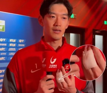 开云体育服务-颜骏凌：赛前热身手指脱臼，这时候更需要给球队信心所以坚持完赛